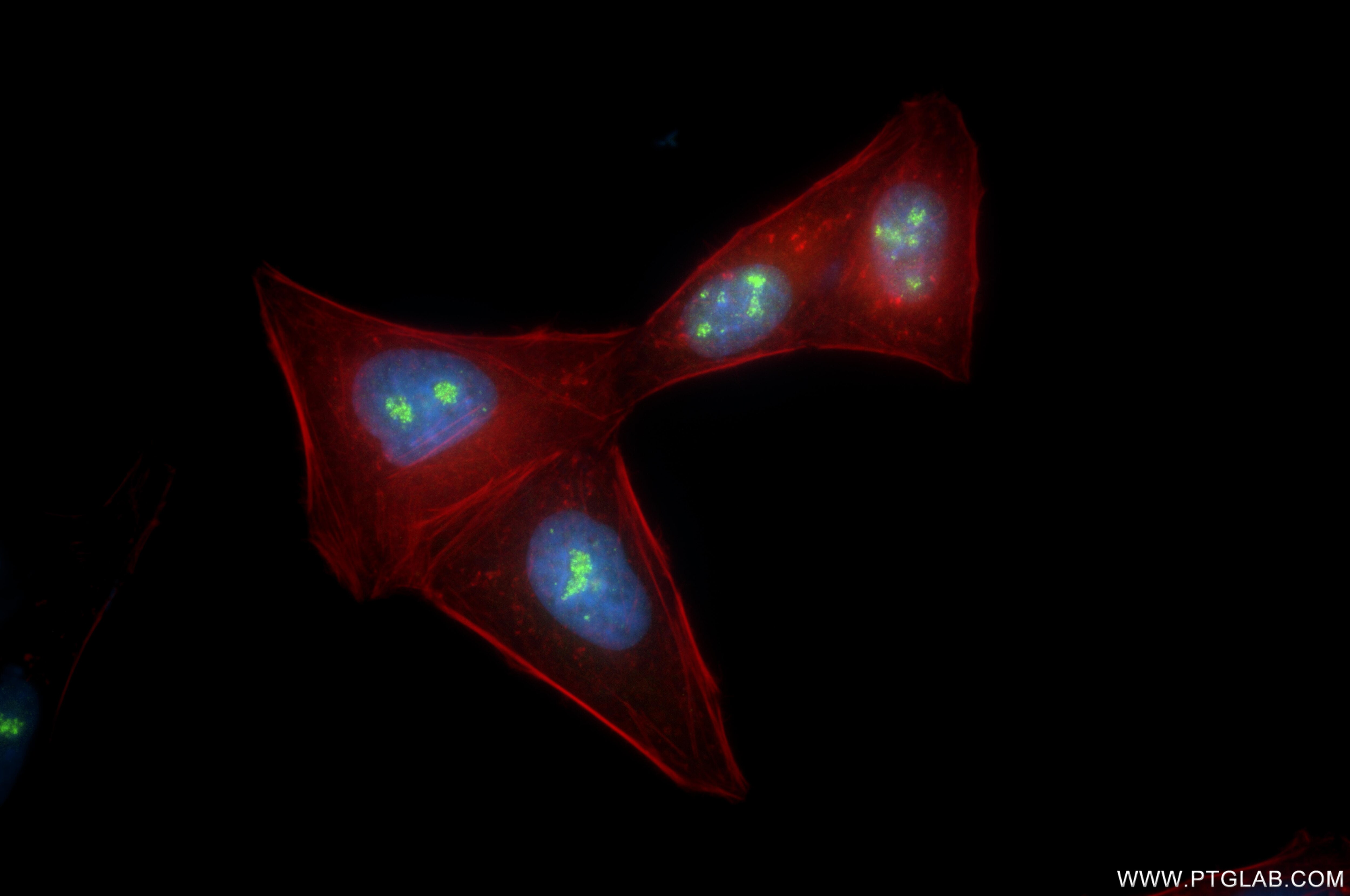 Immunofluorescence (IF) / fluorescent staining of HepG2 cells using P130 Recombinant monoclonal antibody (87016-1-RR)