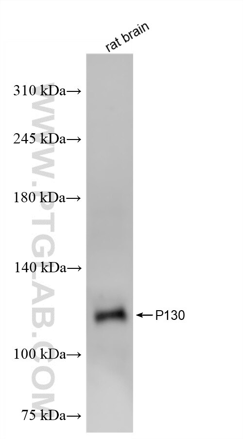 Western Blot (WB) analysis of rat brain tissue using P130 Recombinant monoclonal antibody (87016-1-RR)