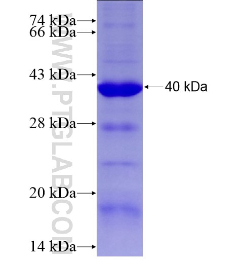 P130 fusion protein Ag28262 SDS-PAGE