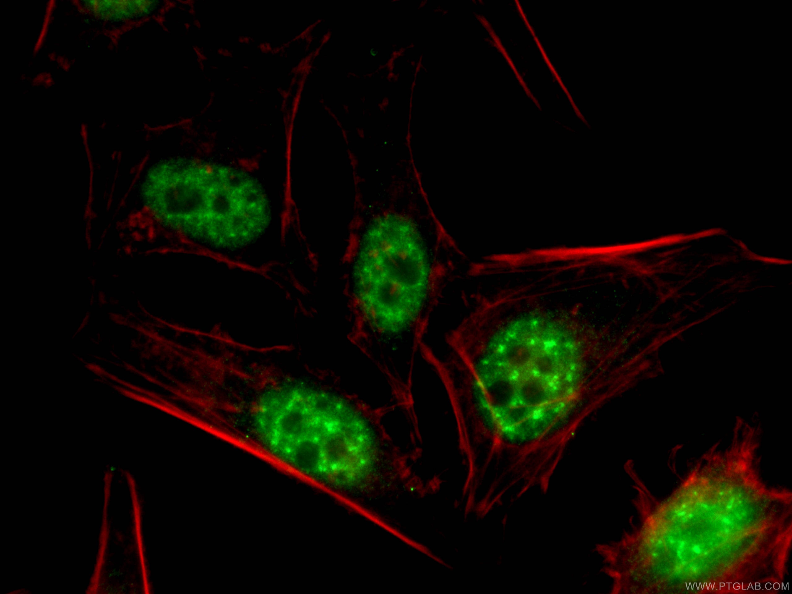 Immunofluorescence (IF) / fluorescent staining of HeLa cells using P15RS Polyclonal antibody (23652-1-AP)