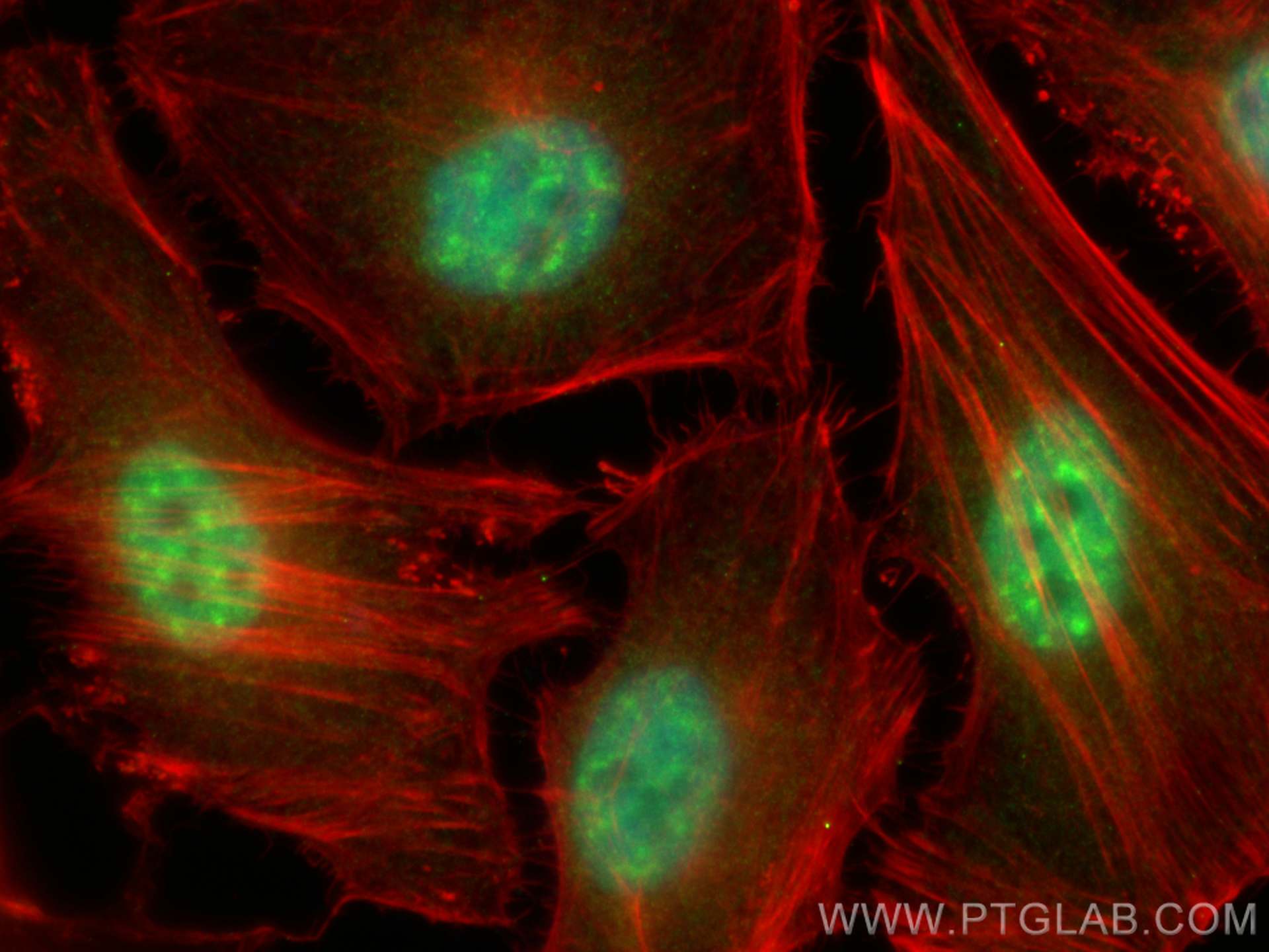 Immunofluorescence (IF) / fluorescent staining of HeLa cells using P15RS Polyclonal antibody (23652-1-AP)