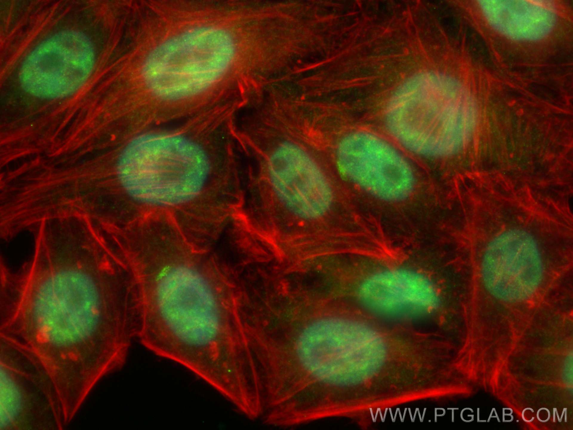 Immunofluorescence (IF) / fluorescent staining of HepG2 cells using P15RS Polyclonal antibody (23652-1-AP)