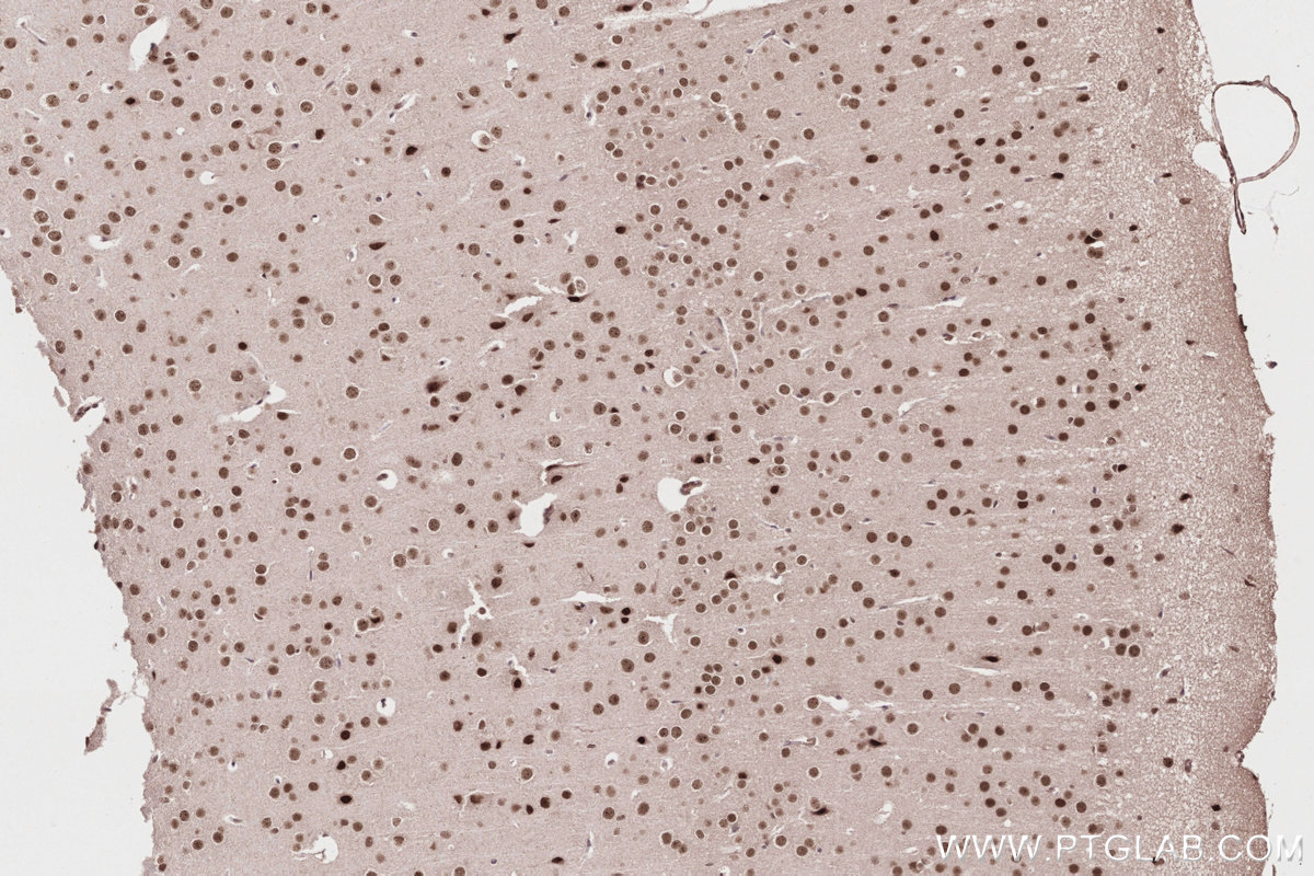 Immunohistochemistry (IHC) staining of mouse brain tissue using P15RS Polyclonal antibody (23652-1-AP)