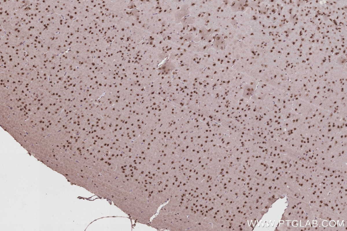 Immunohistochemistry (IHC) staining of rat brain tissue using P15RS Polyclonal antibody (23652-1-AP)