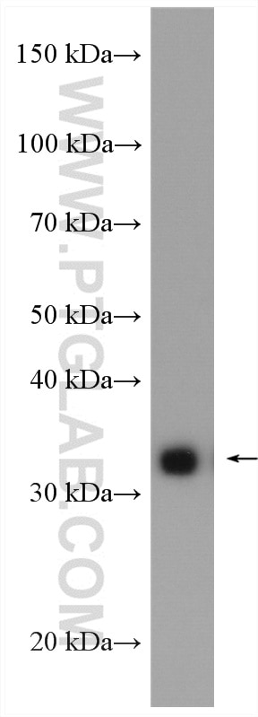 Western Blot (WB) analysis of A431 cells using P15RS Polyclonal antibody (23652-1-AP)