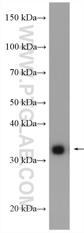 Western Blot (WB) analysis of A431 cells using P15RS Polyclonal antibody (23652-1-AP)