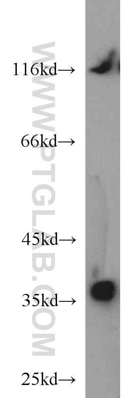 Western Blot (WB) analysis of mouse liver tissue using P15RS Polyclonal antibody (23652-1-AP)