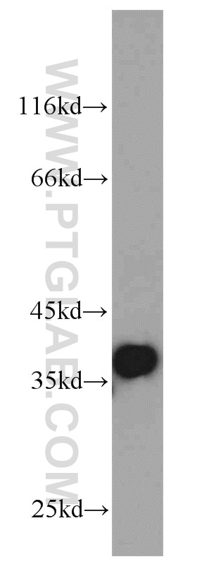 Western Blot (WB) analysis of mouse skeletal muscle tissue using P15RS Polyclonal antibody (23652-1-AP)
