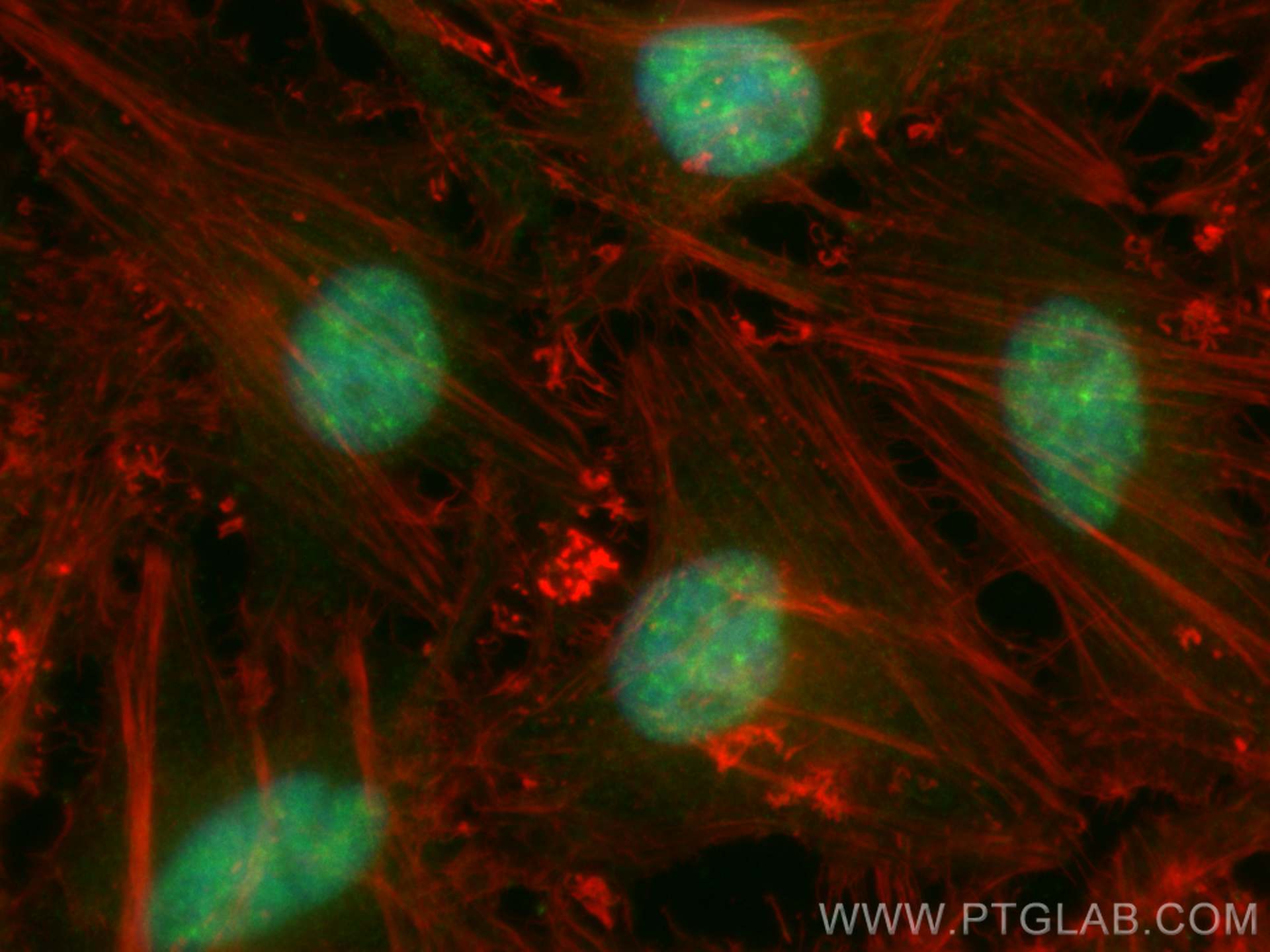 IF Staining of HeLa using CL488-23652