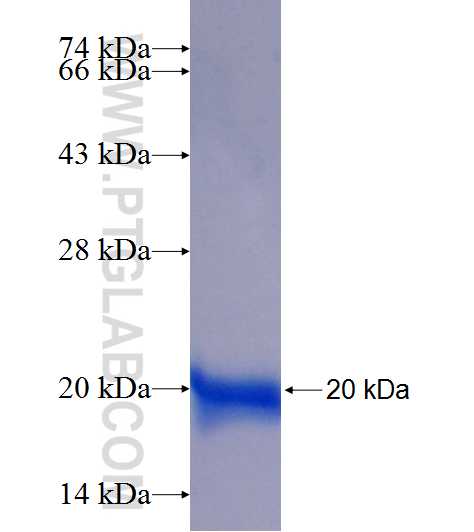 P15RS fusion protein Ag20409 SDS-PAGE