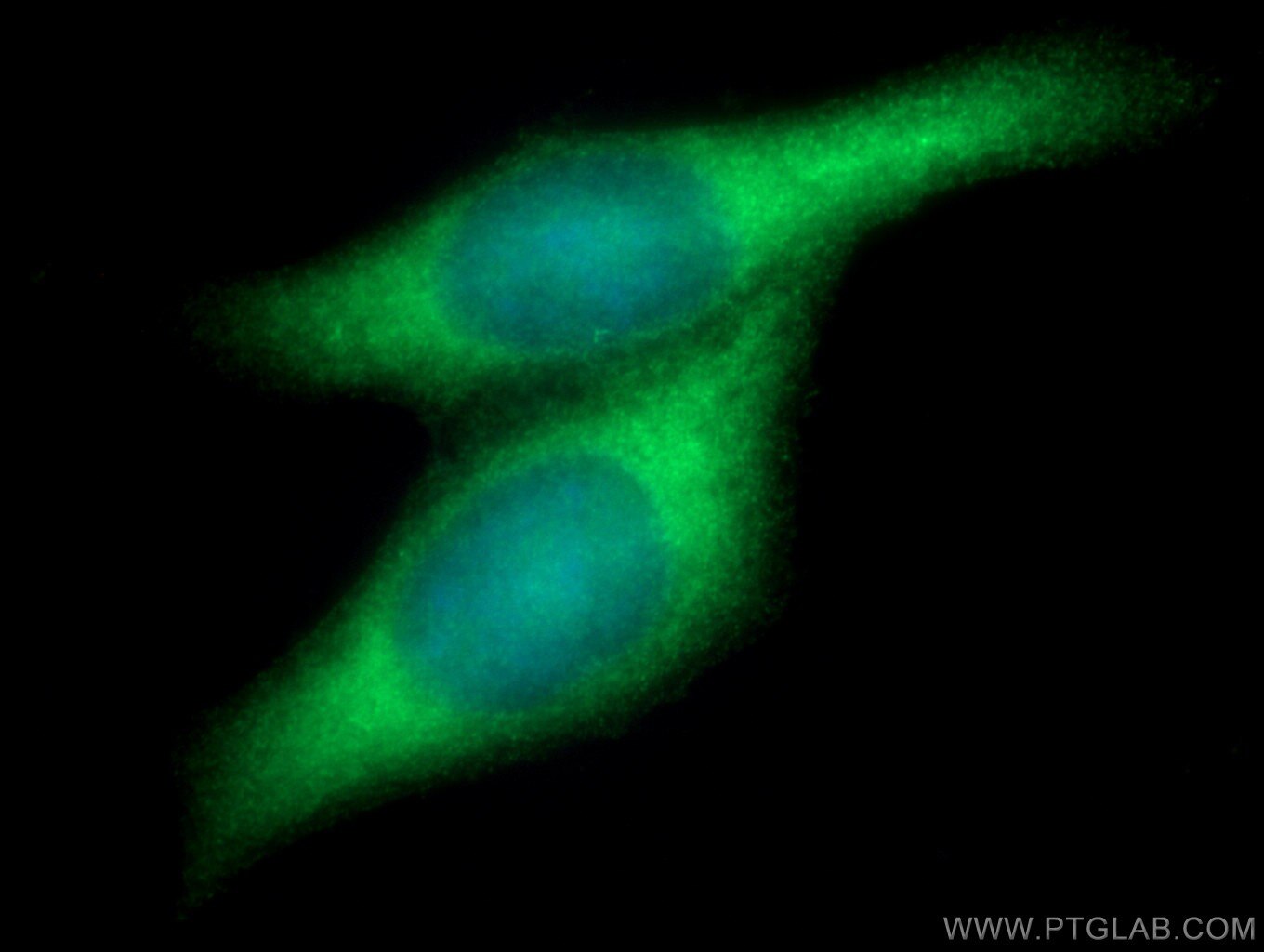 Immunofluorescence (IF) / fluorescent staining of HeLa cells using P16-INK4A Polyclonal antibody (10883-1-AP)