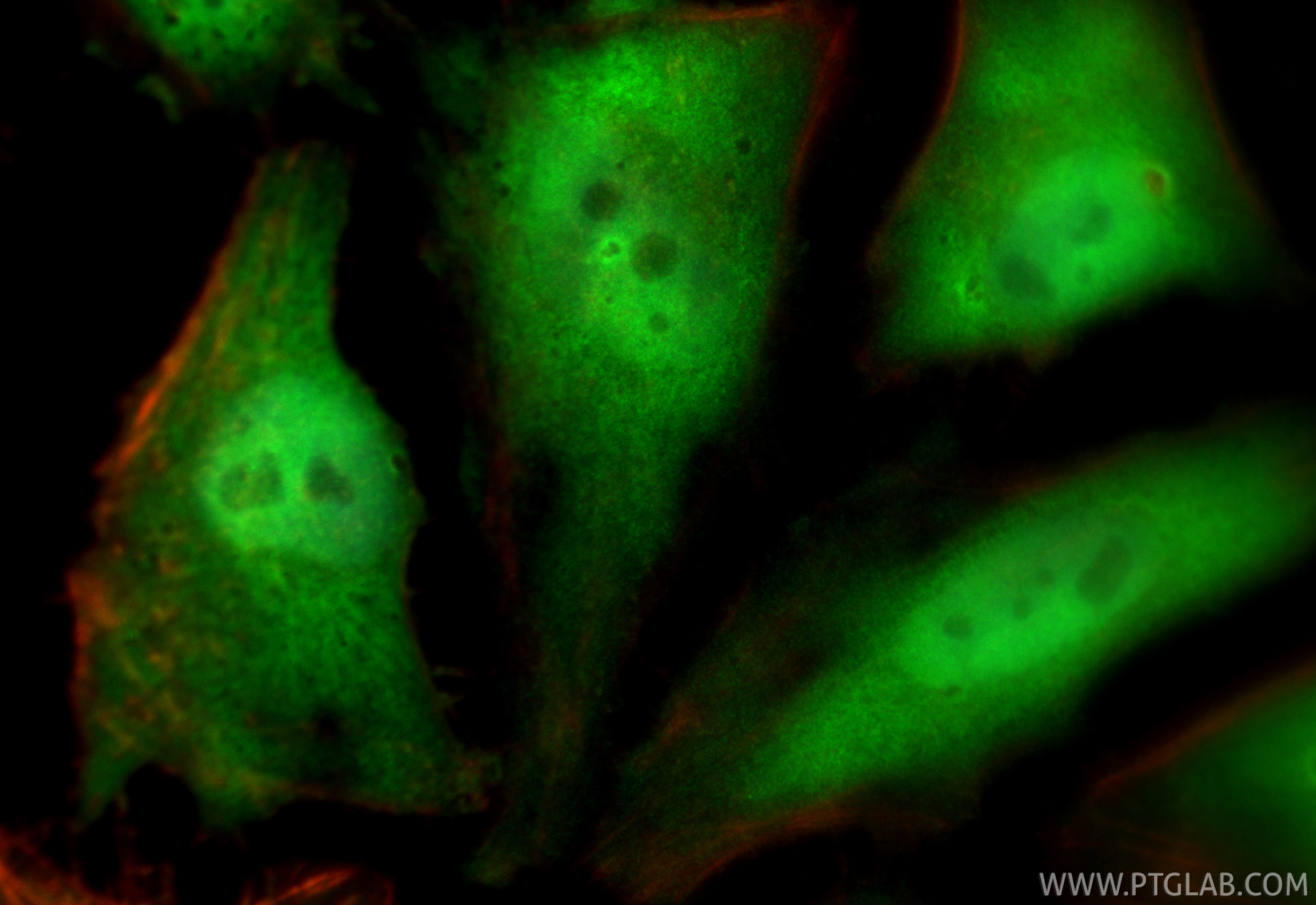 Immunofluorescence (IF) / fluorescent staining of HeLa cells using CDKN2A/P16-INK4A Polyclonal antibody (10883-1-AP)