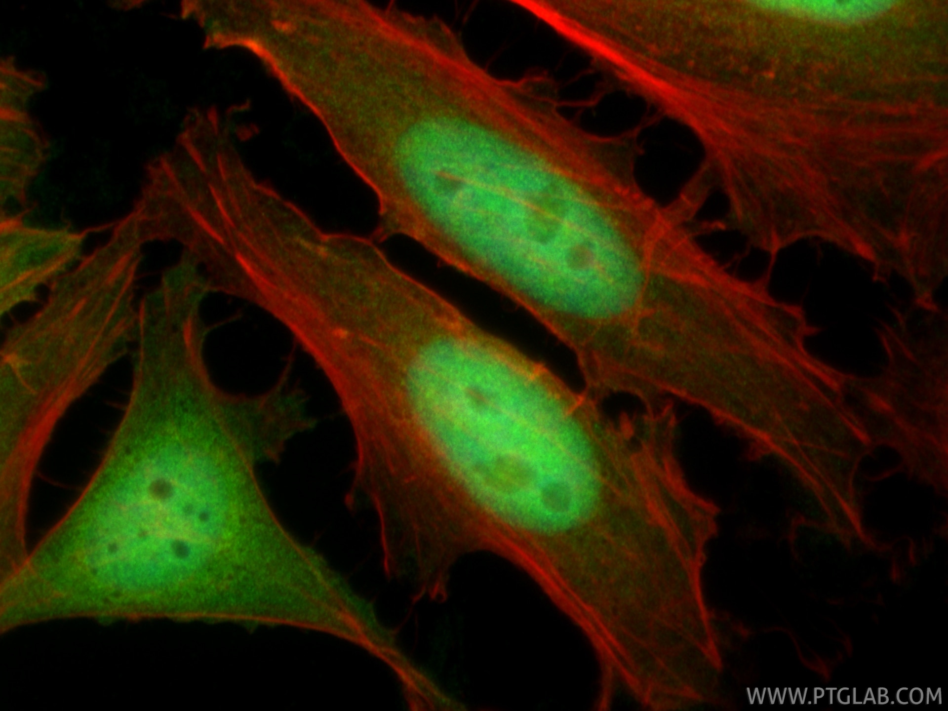 IF Staining of HeLa using 10883-1-AP Immunofluorescence (IF) / fluorescent staining of HeLa cells using CDKN2A/P16-INK4A Polyclonal antibody (10883-1-AP)