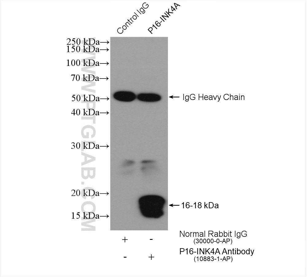 Immunoprecipitation (IP) experiment of HEK-293 cells using P16-INK4A Polyclonal antibody (10883-1-AP)