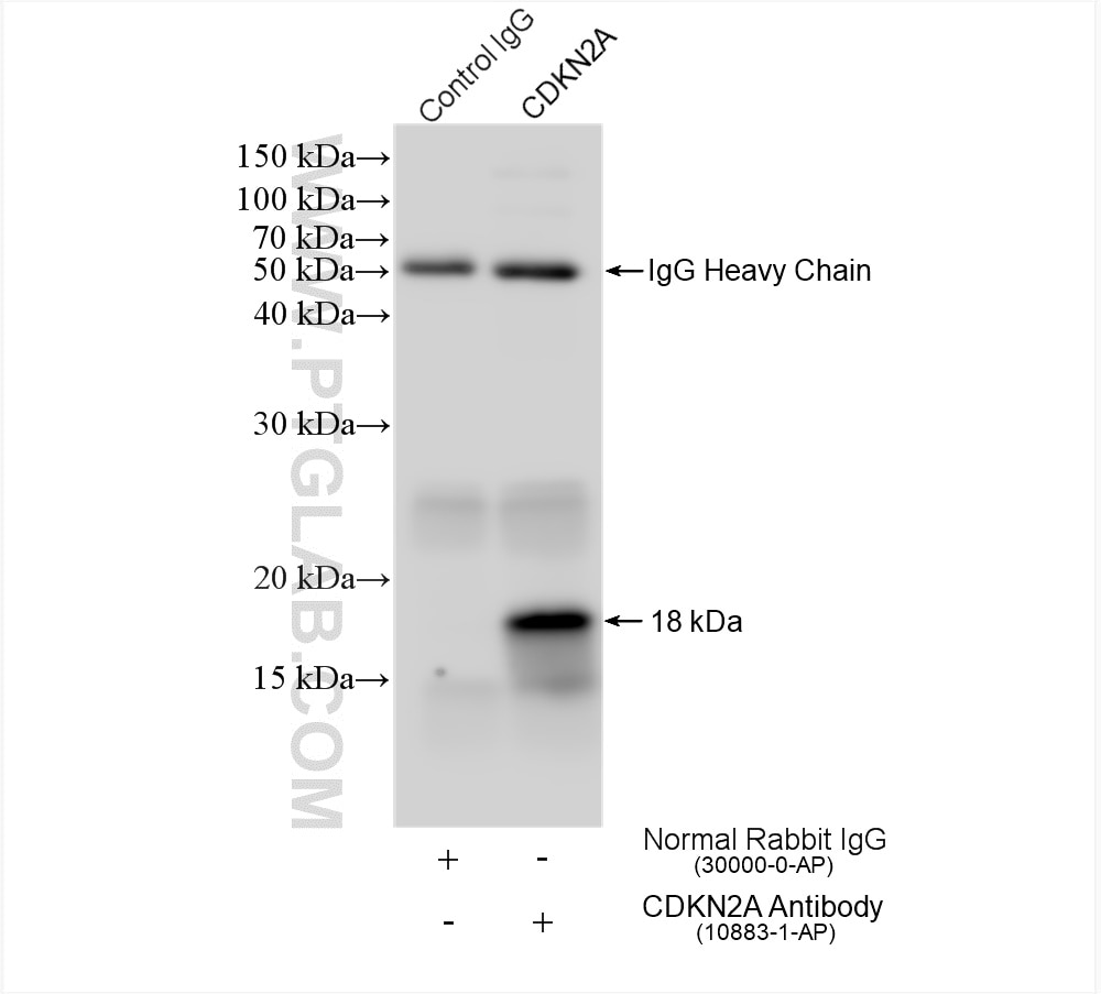 Immunoprecipitation (IP) experiment of HEK-293 cells using P16-INK4A Polyclonal antibody (10883-1-AP)