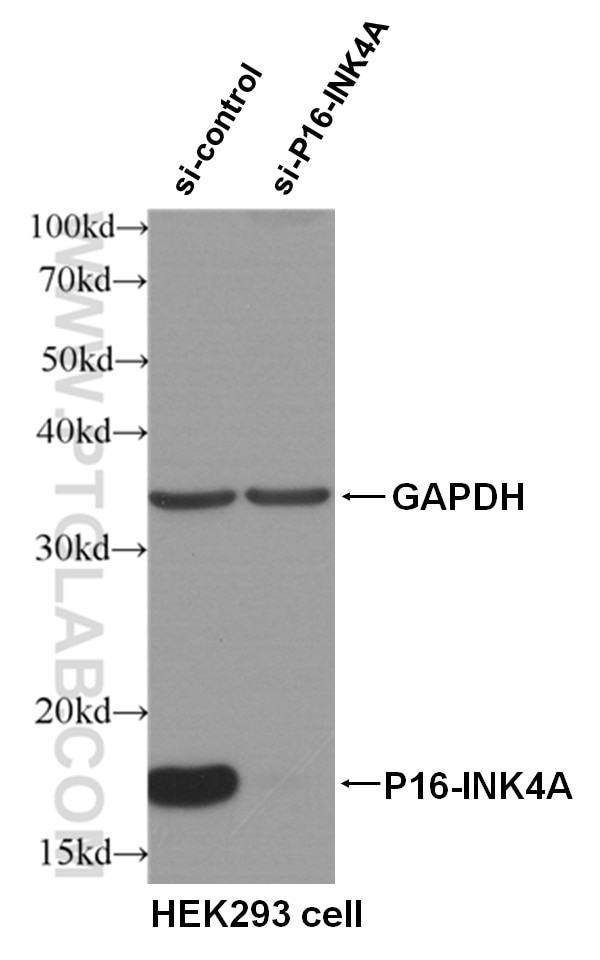 Western Blot (WB) analysis of HEK293 cells using P16-INK4A Polyclonal antibody (10883-1-AP)