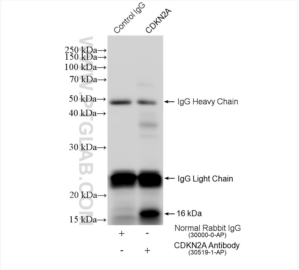 Immunoprecipitation (IP) experiment of HEK-293 cells using P16-INK4A Polyclonal antibody (30519-1-AP)
