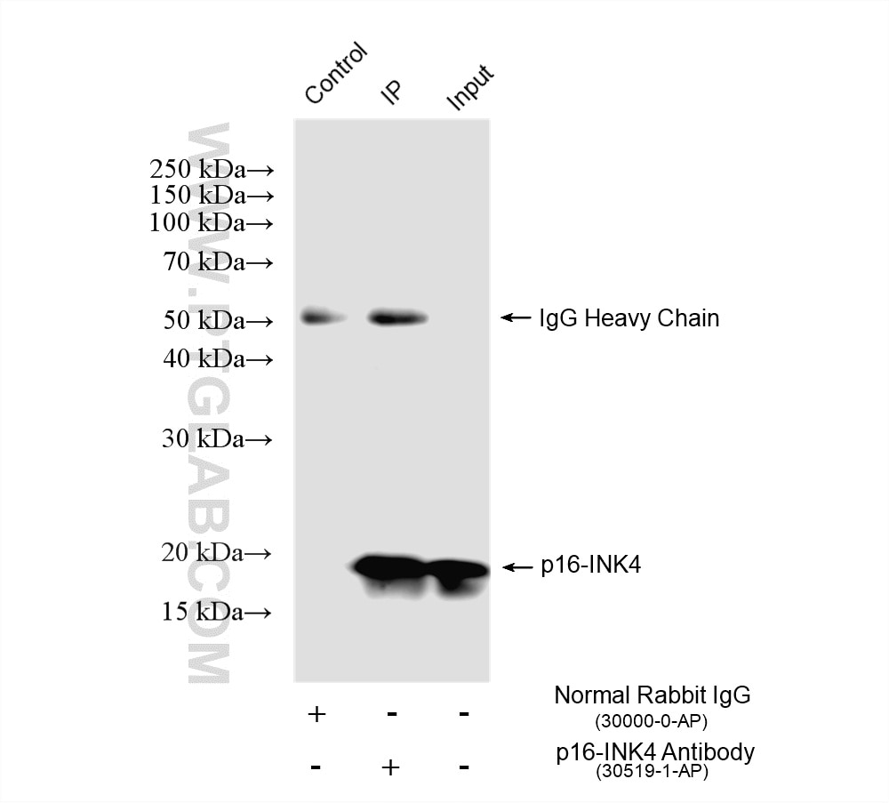 IP experiment of HEK-293 using 30519-1-AP Immunoprecipitation (IP) experiment of HEK-293 cells using CDKN2A/P16-INK4A Polyclonal antibody (30519-1-AP)