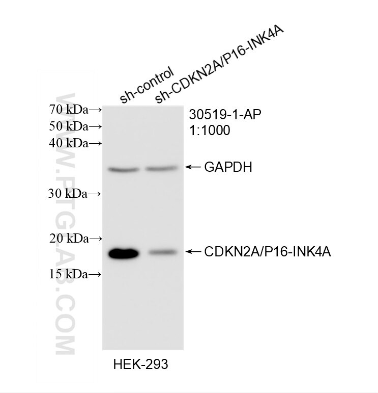 WB result of CDKN2A/P16-INK4A antibody (30519-1-AP; 1:1000; incubated at room temperature for 1.5 hours) with sh-Control and sh-CDKN2A/P16-INK4A transfected HEK-293 cells. Western Blot (WB) analysis of HEK-293 cells using CDKN2A/P16-INK4A Polyclonal antibody (30519-1-AP)