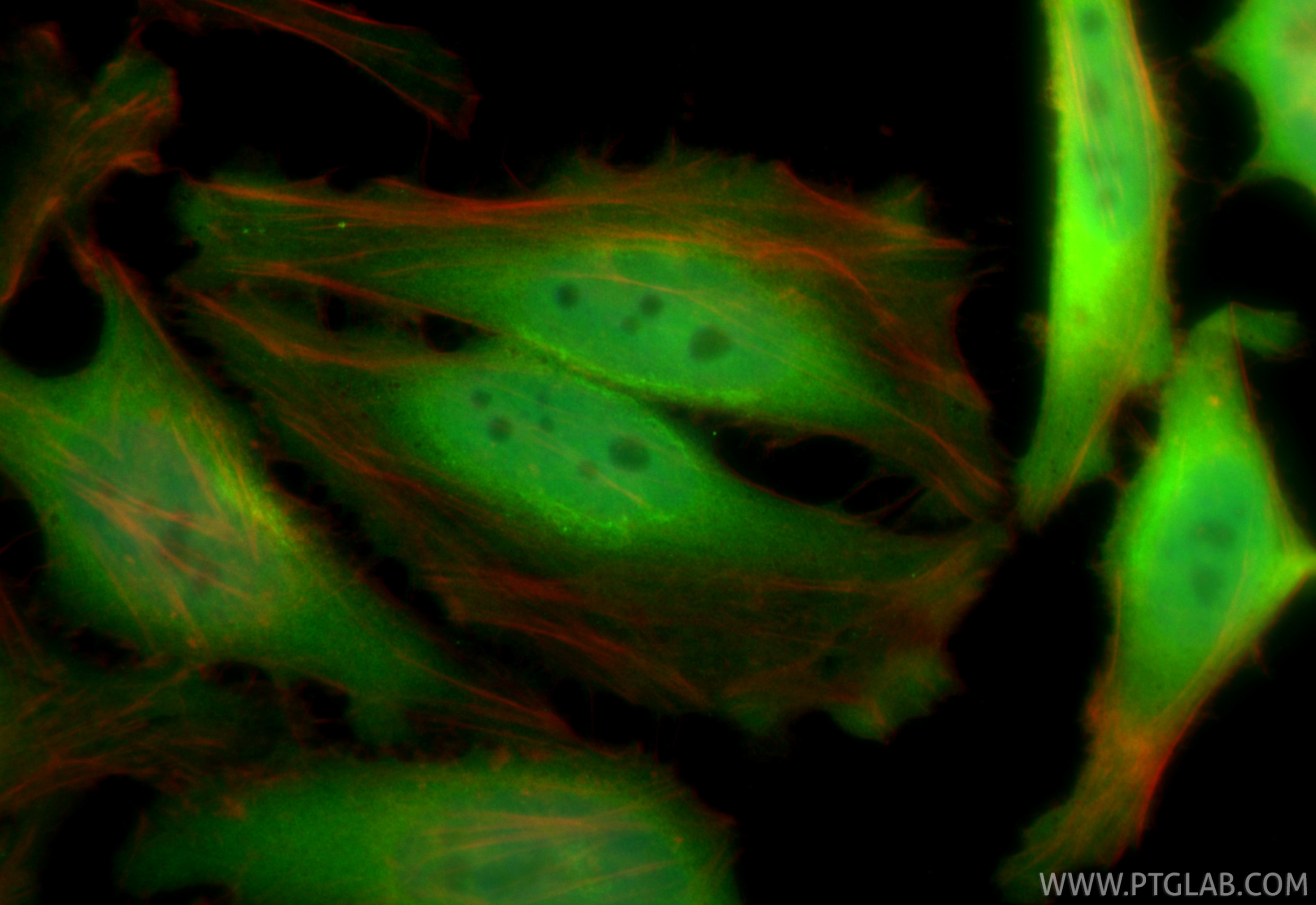 Immunofluorescent analysis of (4% PFA) fixed HeLa cells using CDKN2A/P16-INK4A antibody (81373-10-RR, Clone: 241438B2 ) at dilution of 1:400 and CoraLite®488-Conjugated Goat Anti-Rabbit IgG(H+L) (SA00013-2), CL594-Phalloidin (red). Immunofluorescence (IF) / fluorescent staining of HeLa cells using CDKN2A/P16-INK4A Recombinant antibody (81373-10-RR)
