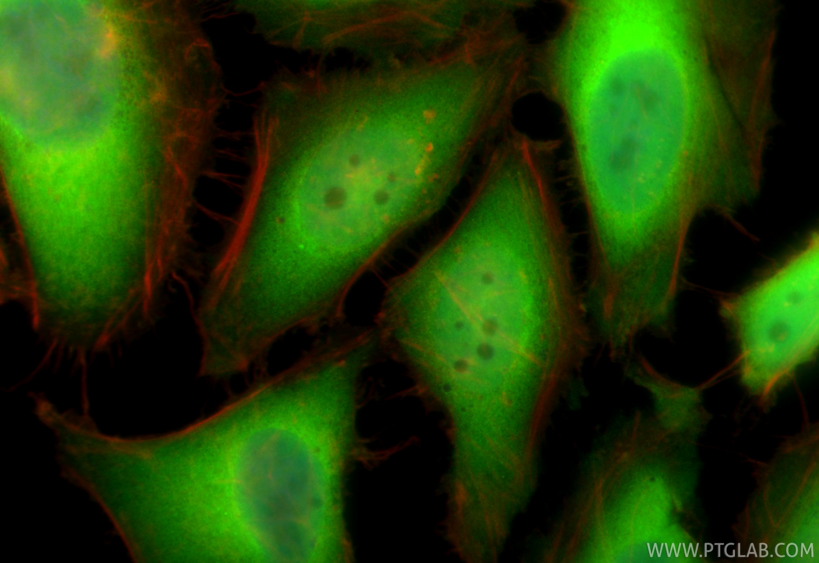 Immunofluorescence (IF) / fluorescent staining of HeLa cells using CDKN2A/P16-INK4A Recombinant antibody (81373-8-RR)