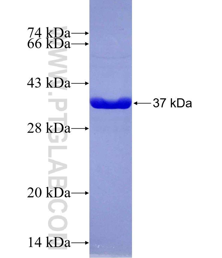 P16-INK4A fusion protein Ag29567 SDS-PAGE
