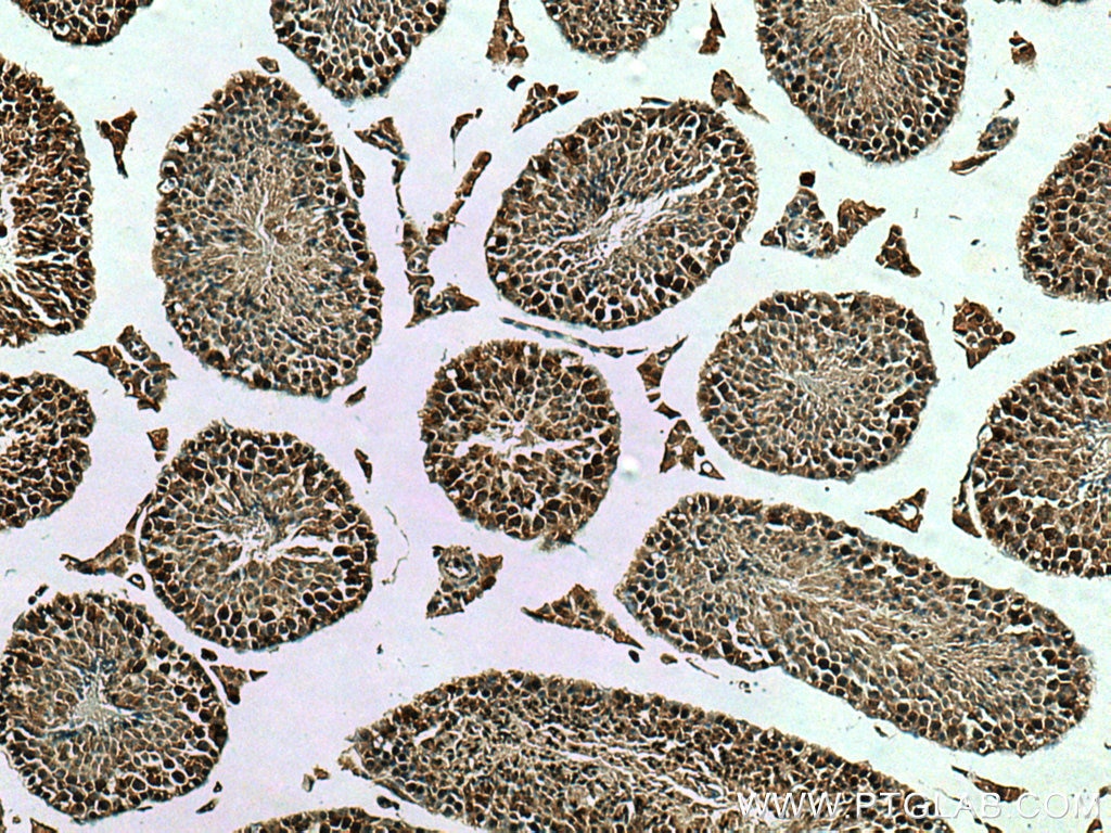 Immunohistochemistry (IHC) staining of mouse testis tissue using p19 INK4d Polyclonal antibody (10272-2-AP)