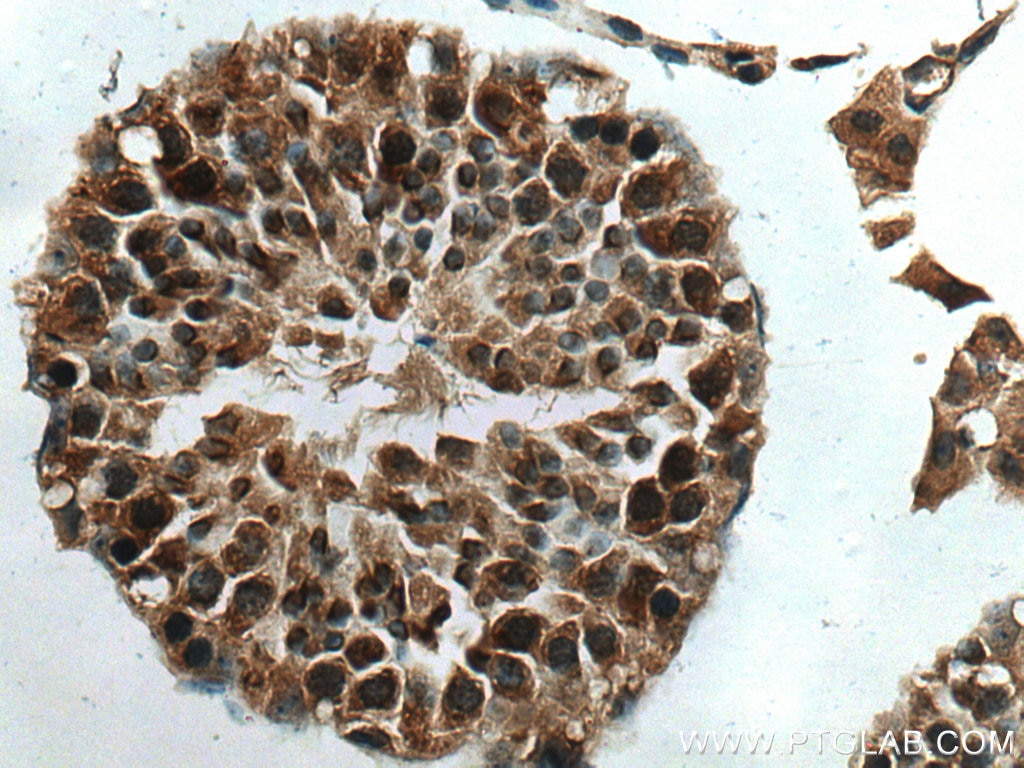 Immunohistochemistry (IHC) staining of mouse testis tissue using p19 INK4d Polyclonal antibody (10272-2-AP)