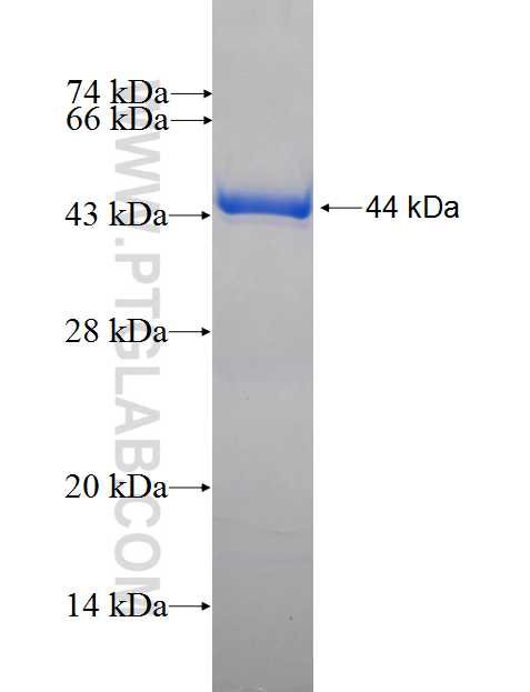 P19 fusion protein Ag0415 SDS-PAGE