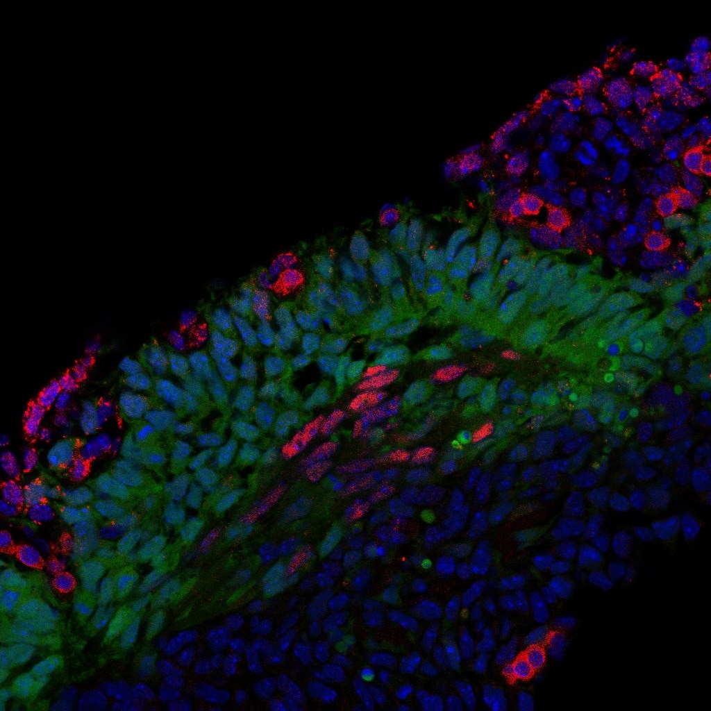 IF Staining of myotome of a somite at E11.5 using 10240-1-AP