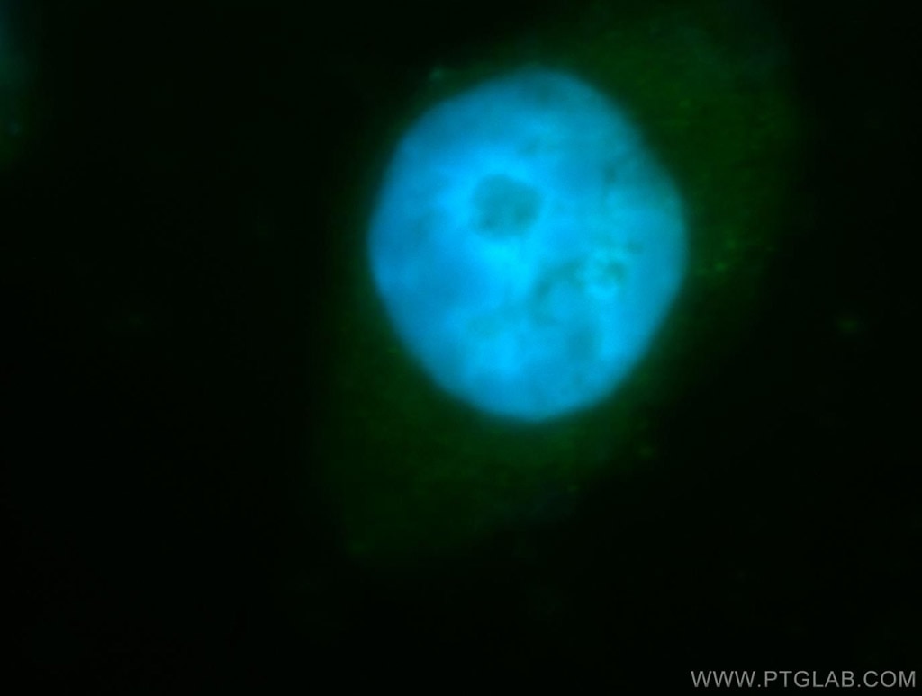 Immunofluorescence (IF) / fluorescent staining of SH-SY5Y cells using P21 Polyclonal antibody (10240-1-AP)
