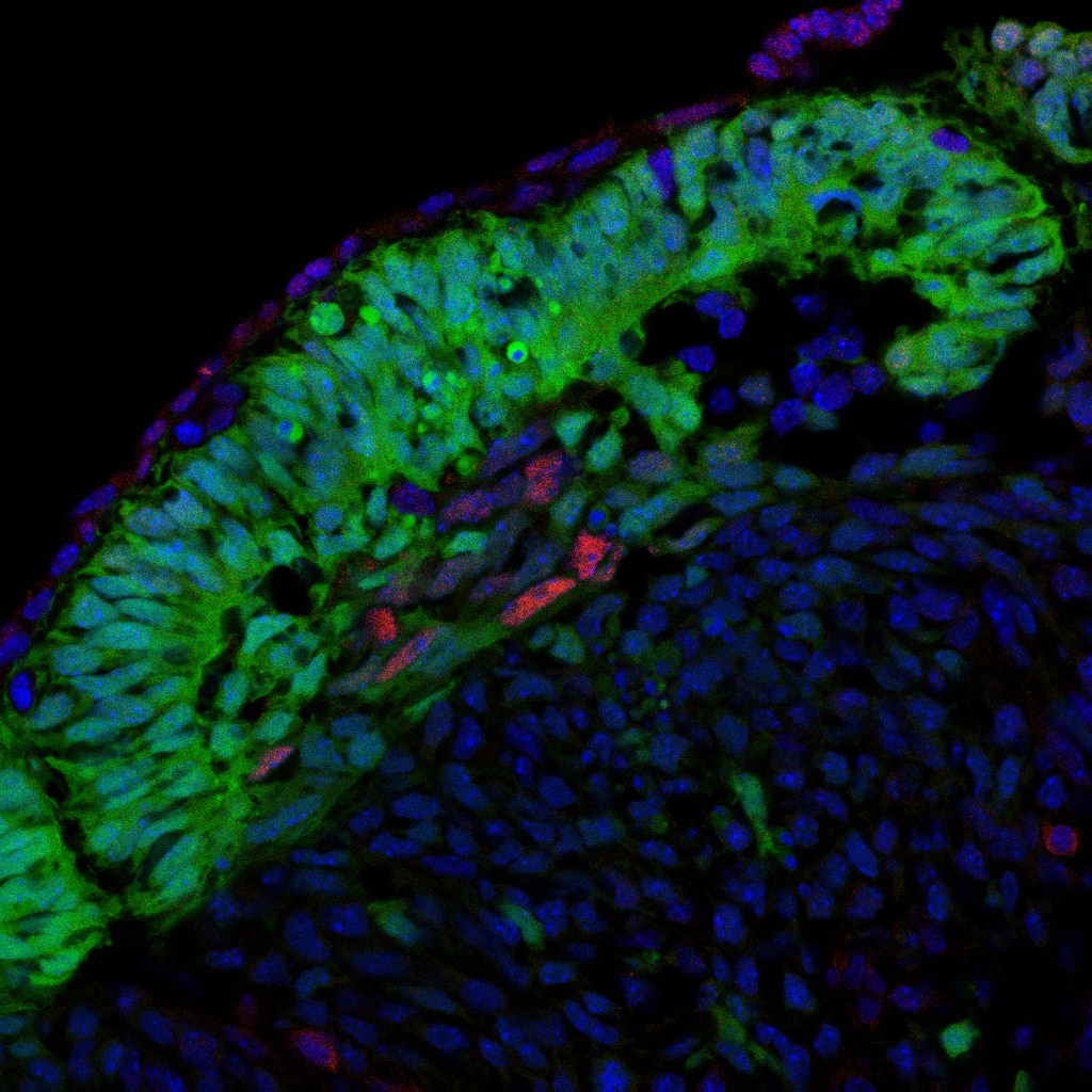 IF Staining of myotome of a somite at E11.5 tissue using 10355-1-AP