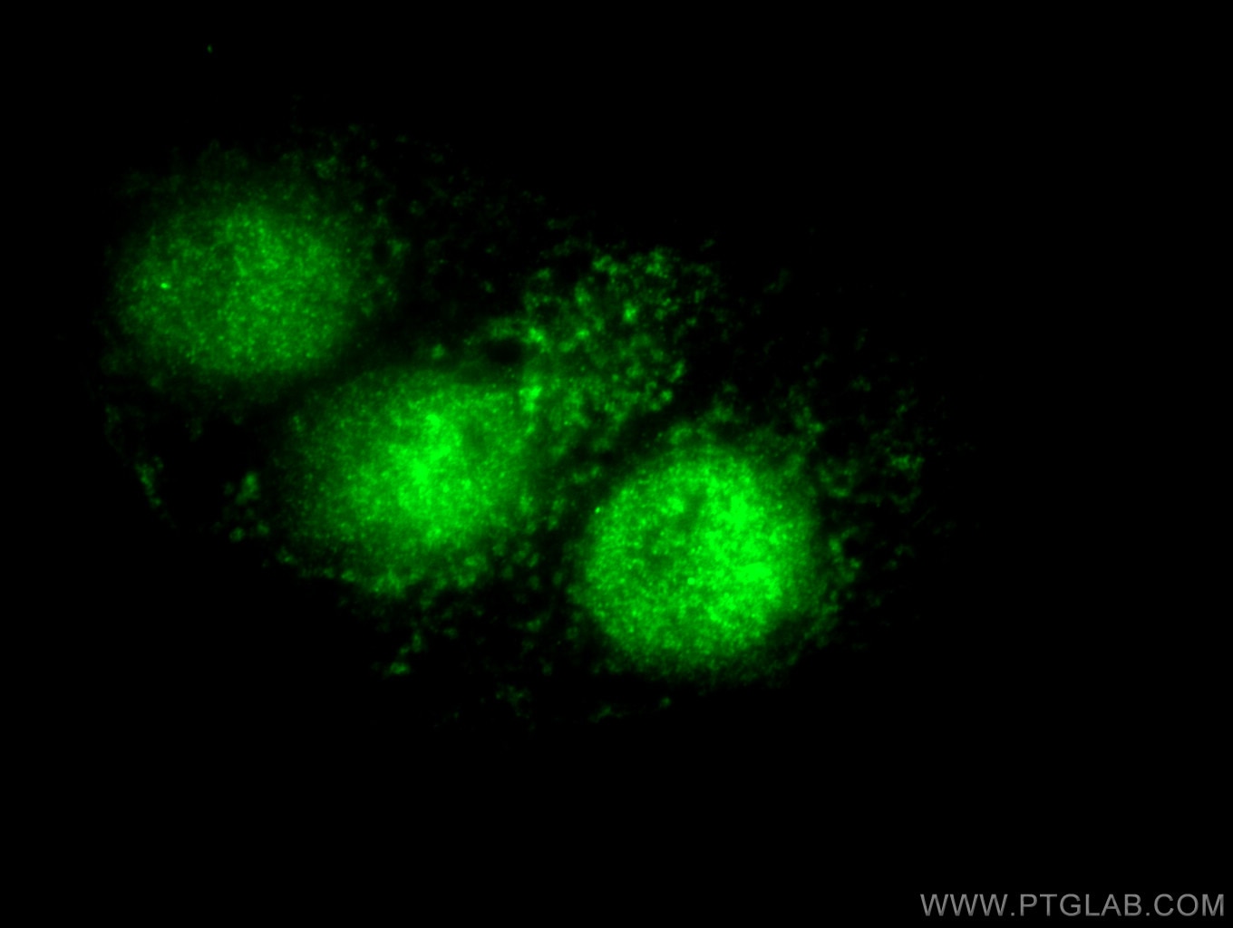 Immunofluorescence (IF) / fluorescent staining of MCF-7 cells using P21 Polyclonal antibody (10355-1-AP)