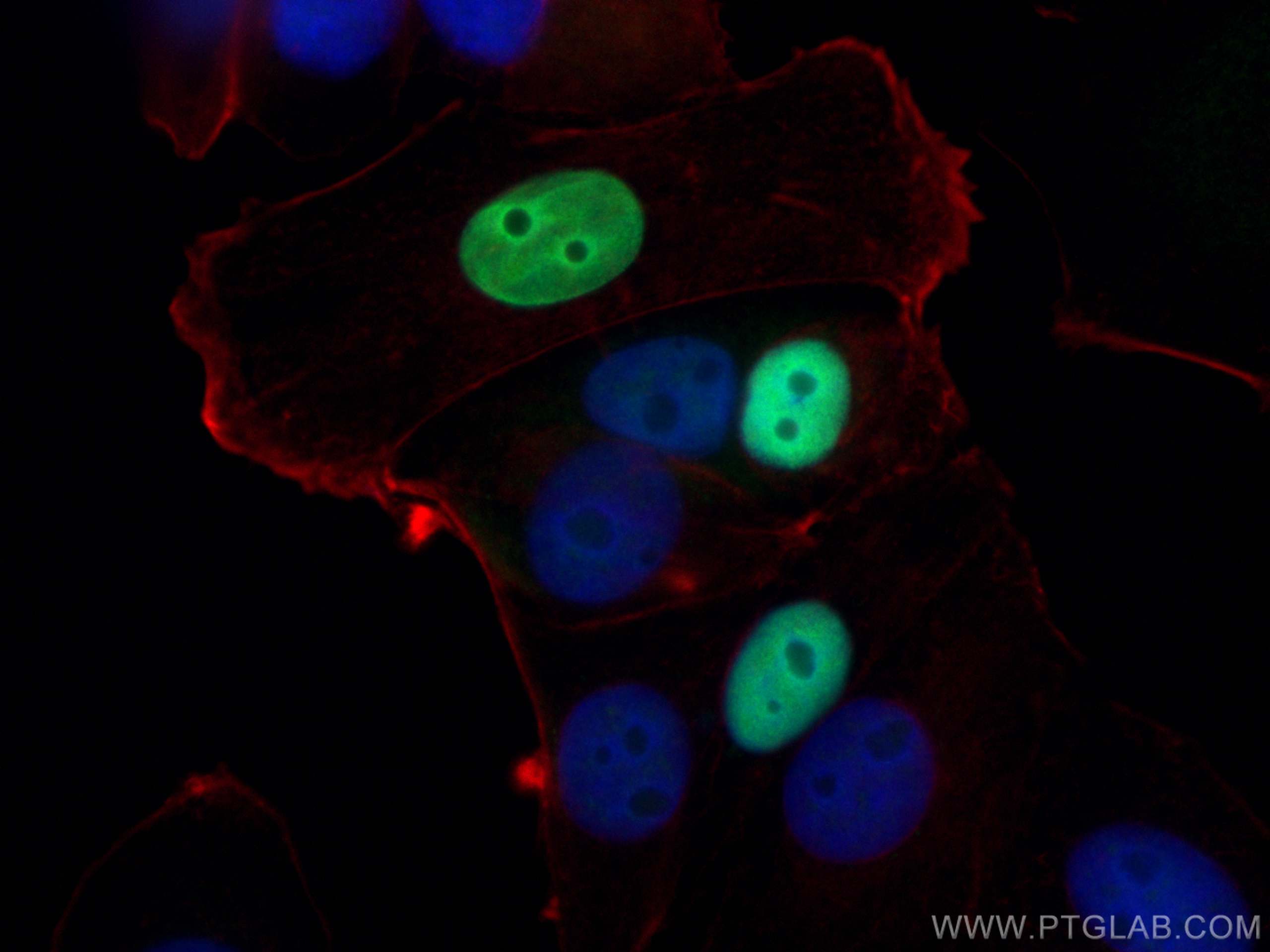 Immunofluorescence (IF) / fluorescent staining of MCF-7 cells using P21 Polyclonal antibody (10355-1-AP)