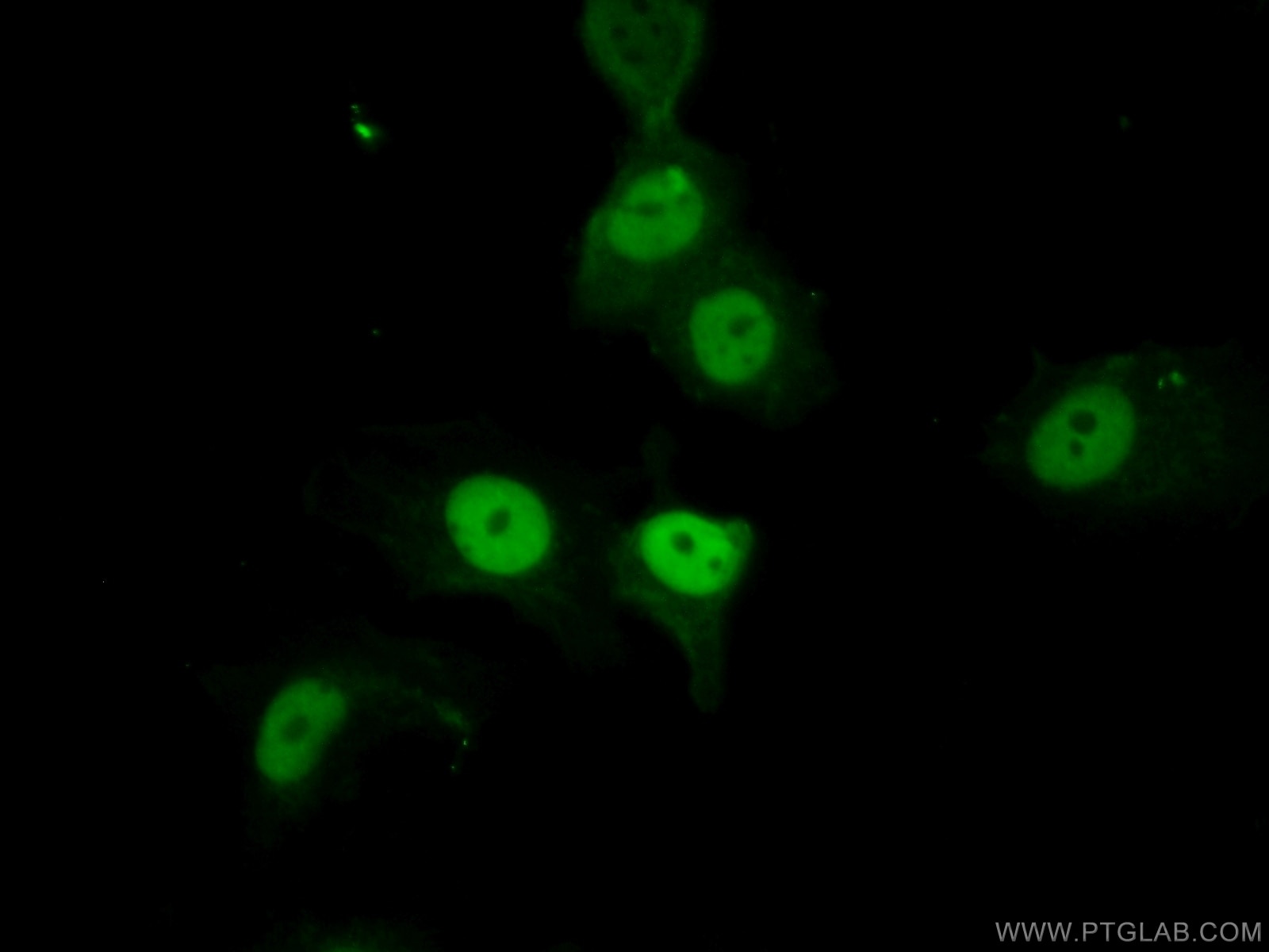 Immunofluorescence (IF) / fluorescent staining of MCF-7 cells using P21 Polyclonal antibody (10355-1-AP)