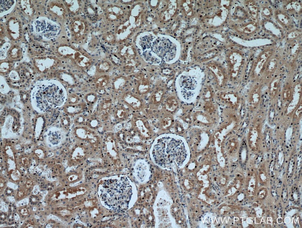 Immunohistochemistry (IHC) staining of human kidney tissue using P21 Polyclonal antibody (10355-1-AP)