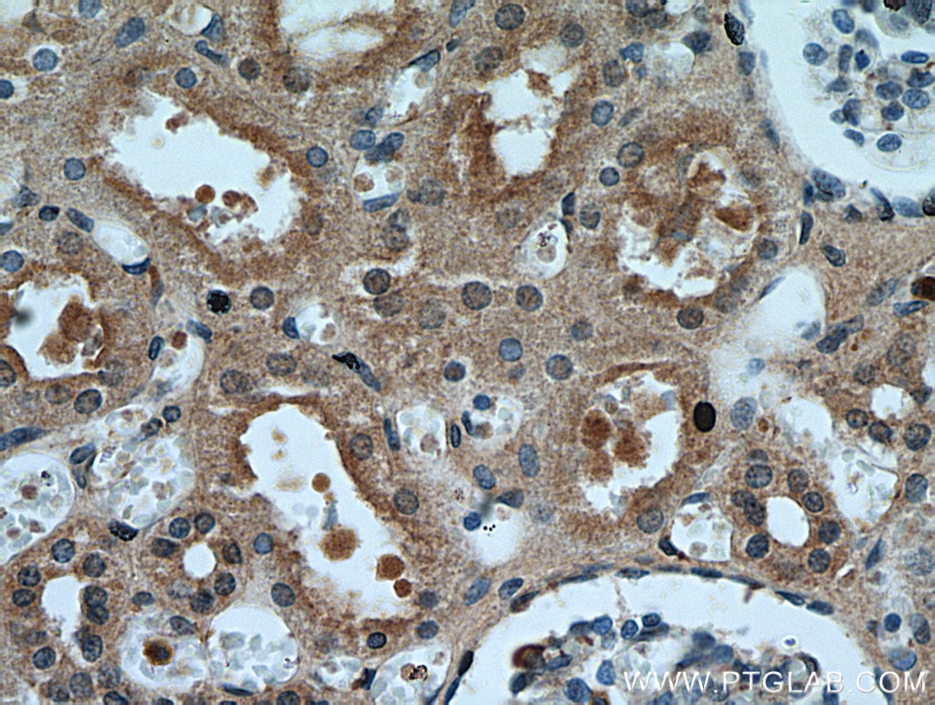 Immunohistochemistry (IHC) staining of human kidney tissue using P21 Polyclonal antibody (10355-1-AP)