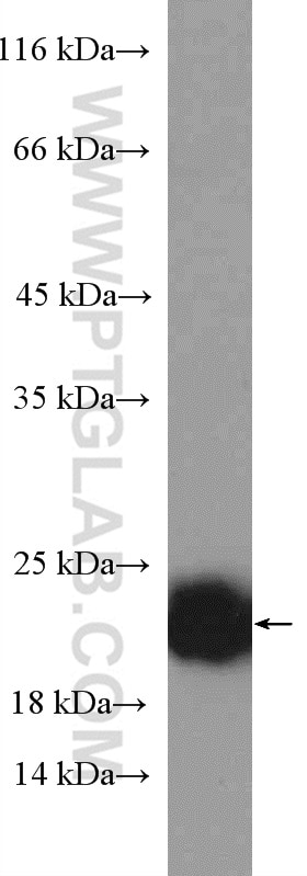 P21 Polyclonal antibody