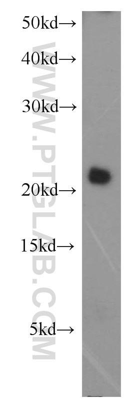 P21 Polyclonal antibody