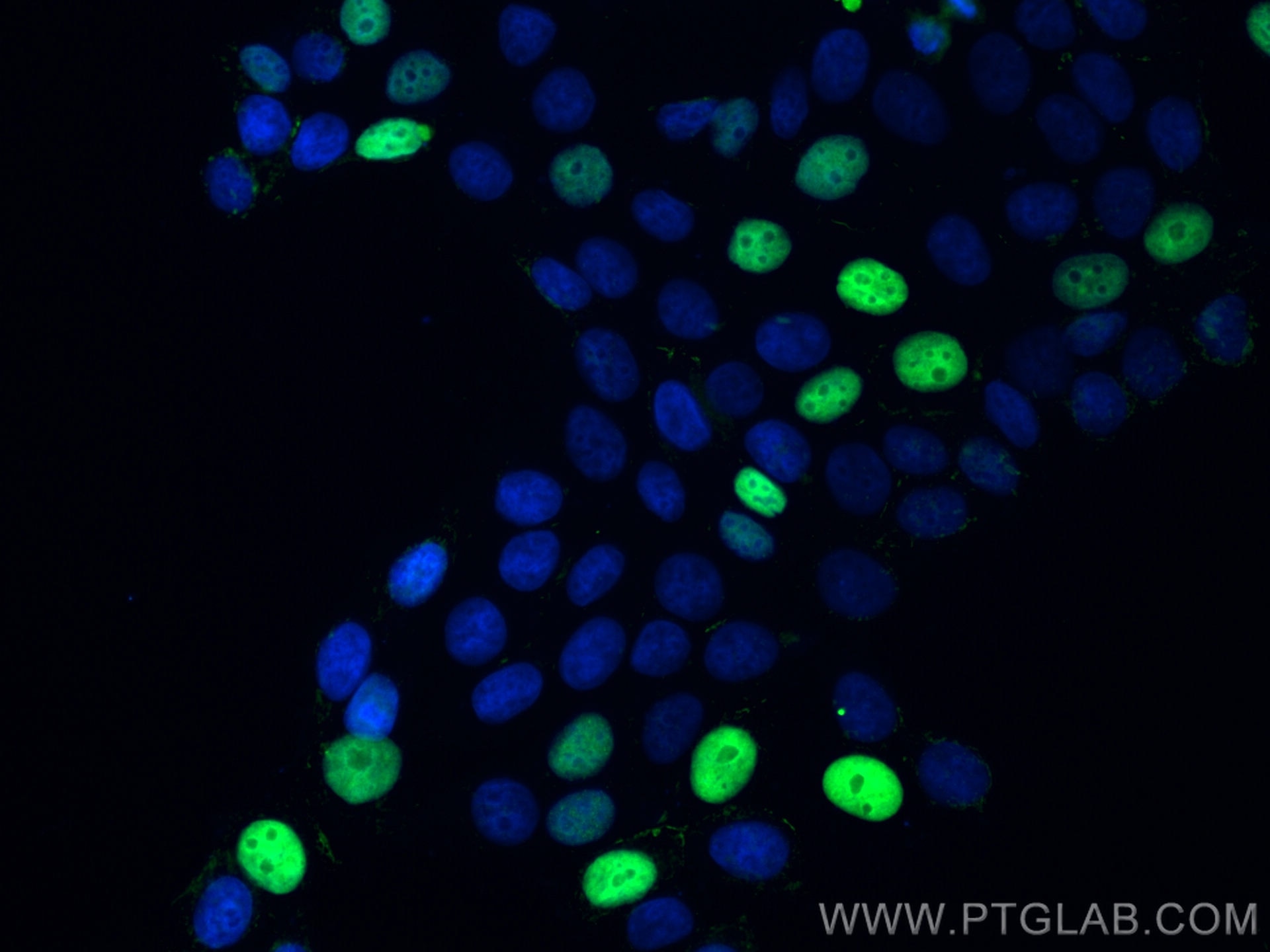 Immunofluorescence (IF) / fluorescent staining of MCF-7 cells using P21 Polyclonal antibody (27296-1-AP)