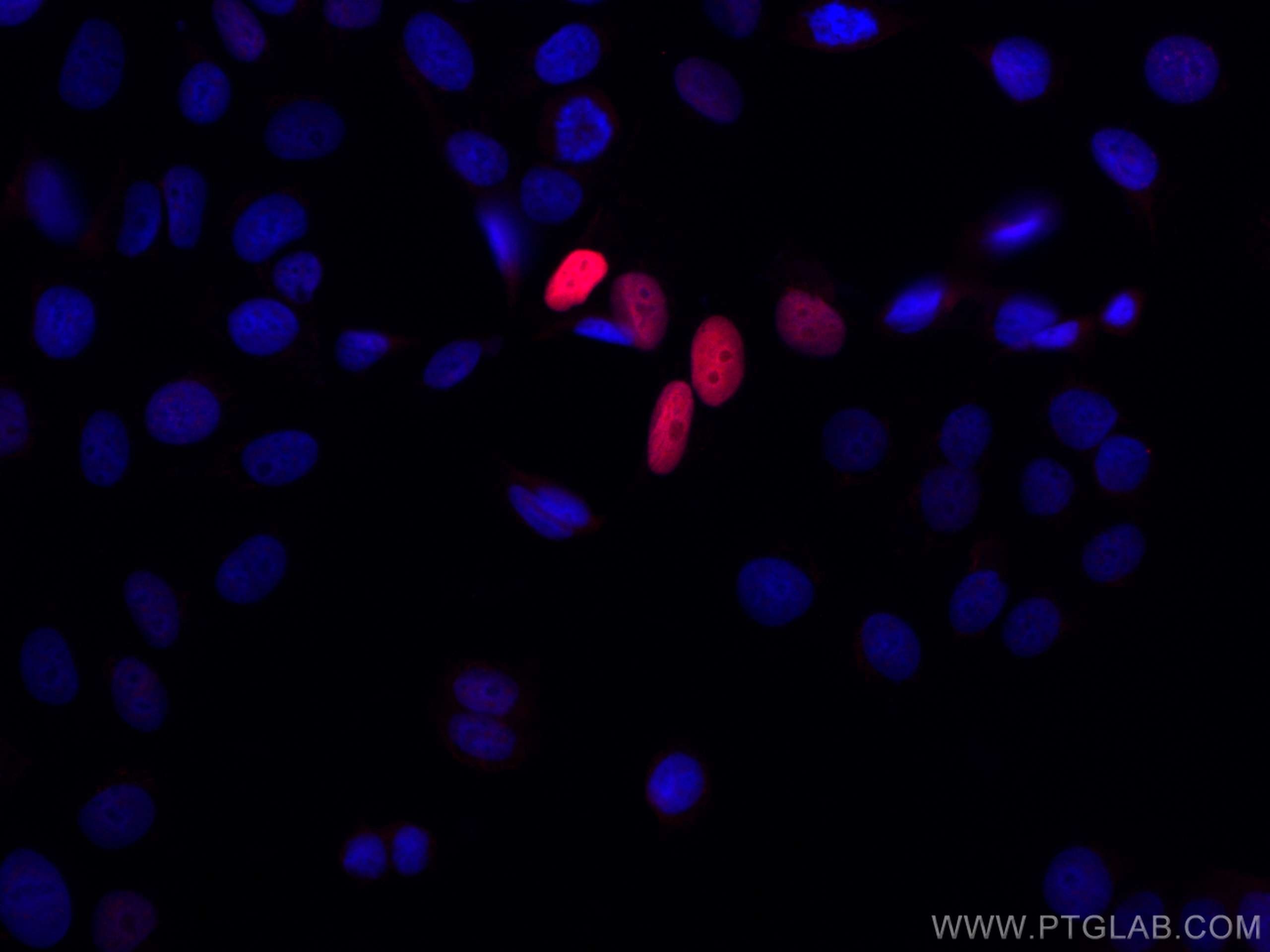 Immunofluorescence (IF) / fluorescent staining of MCF-7 cells using CoraLite®594-conjugated P21 Polyclonal antibody (CL594-10355)