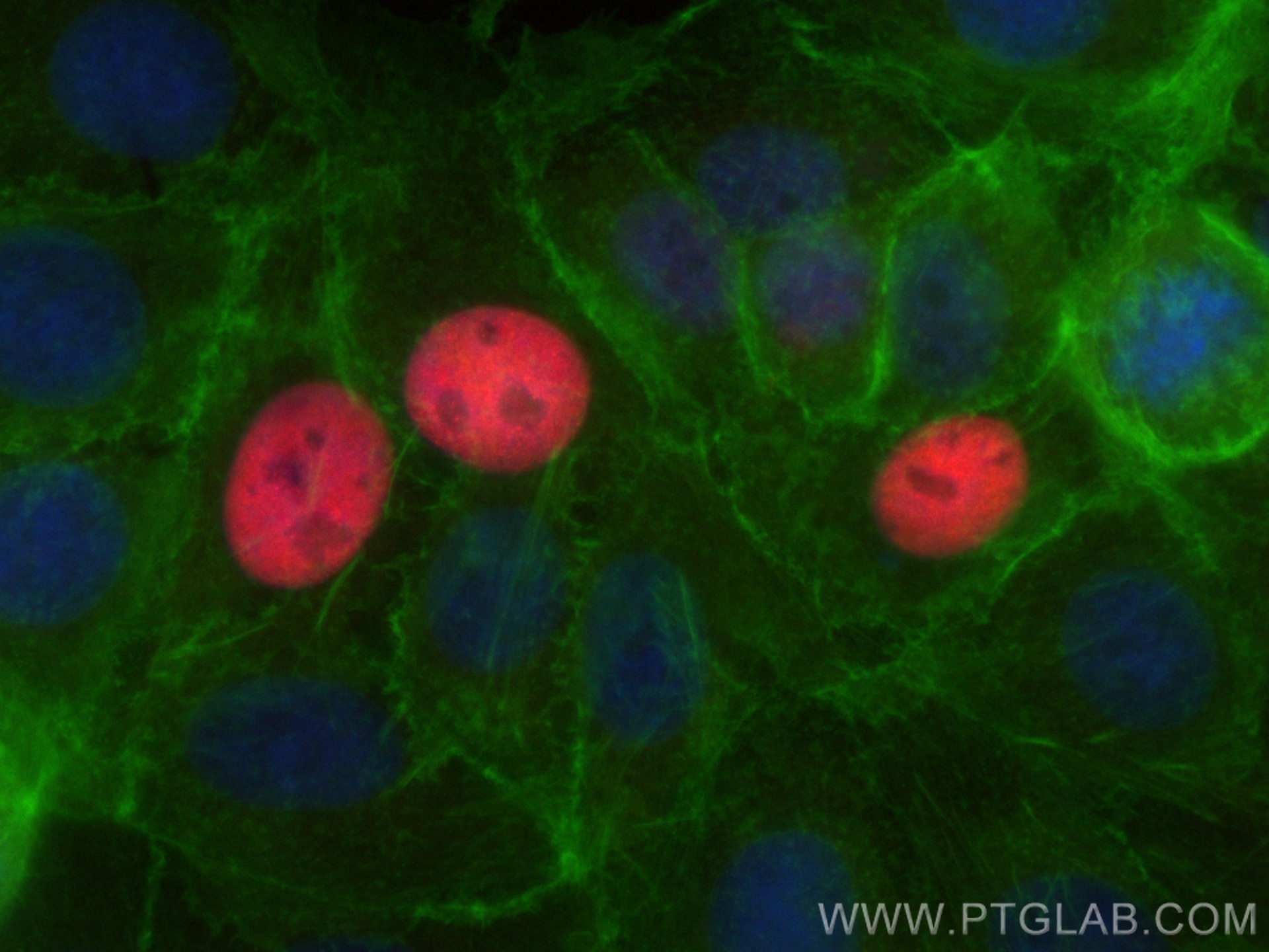 Immunofluorescence (IF) / fluorescent staining of MCF-7 cells using CoraLite®594-conjugated P21 Polyclonal antibody (CL594-10355)
