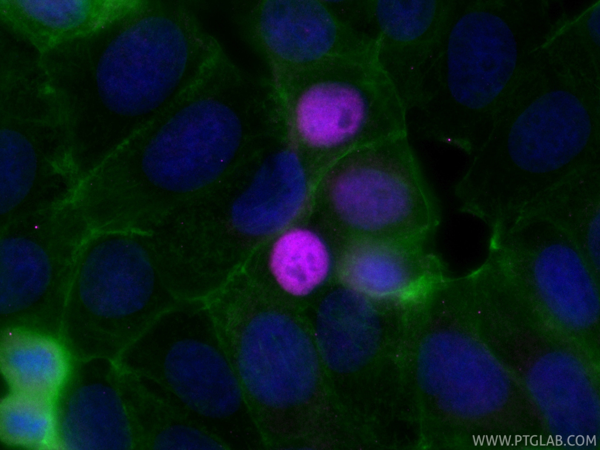 IF Staining of MCF-7 using CL647-82669-2 Immunofluorescence (IF) / fluorescent staining of MCF-7 cells using CoraLite® Plus 647-conjugated P21 Recombinant mono (CL647-82669-2)