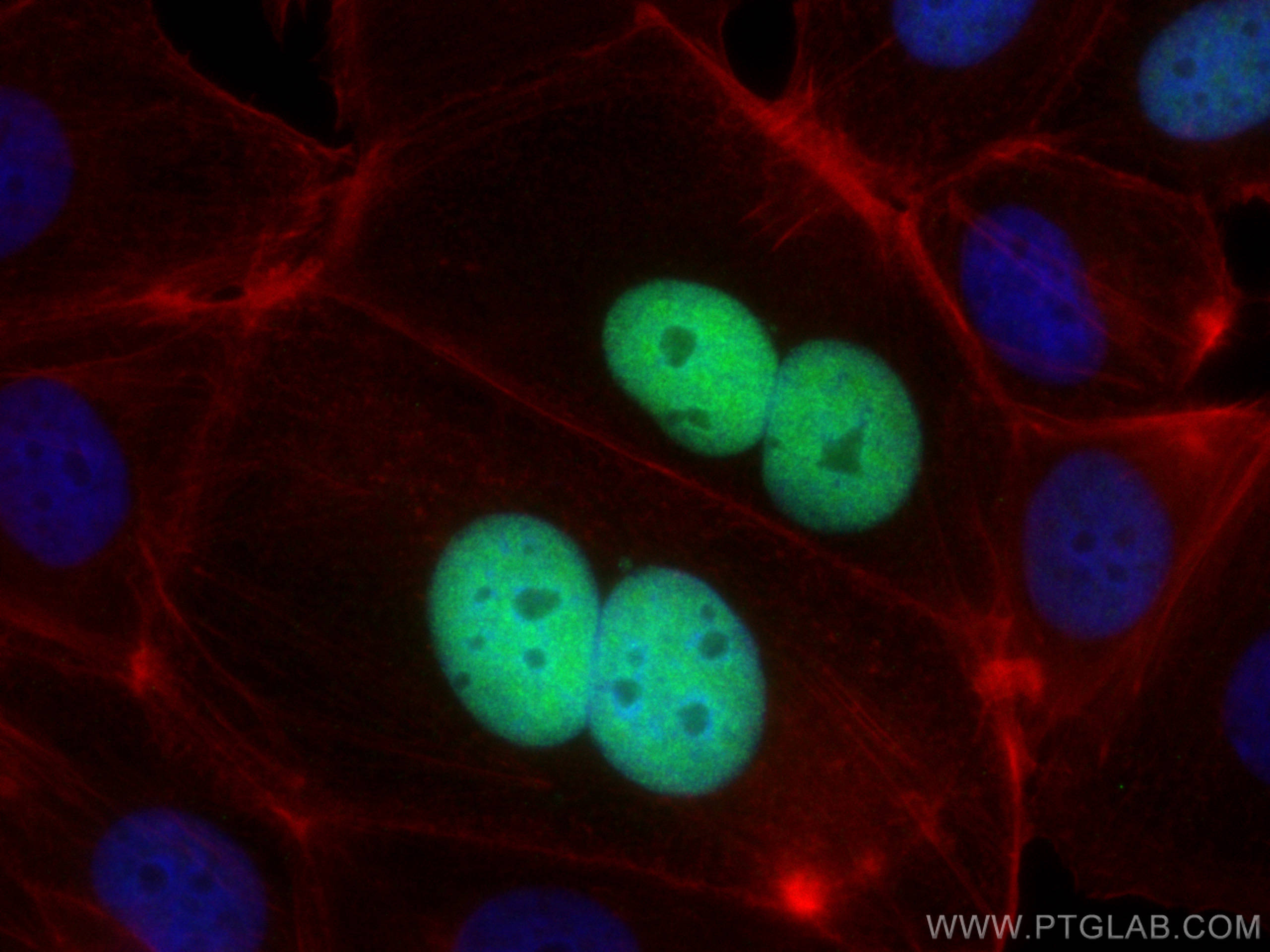 Immunofluorescence (IF) / fluorescent staining of MCF-7 cells using P21 Recombinant antibody (82669-2-RR)
