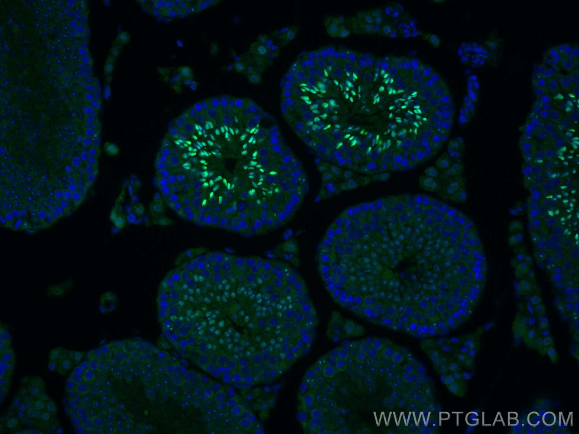 Immunofluorescence (IF) / fluorescent staining of mouse testis tissue using P27; KIP1 Polyclonal antibody (25614-1-AP)