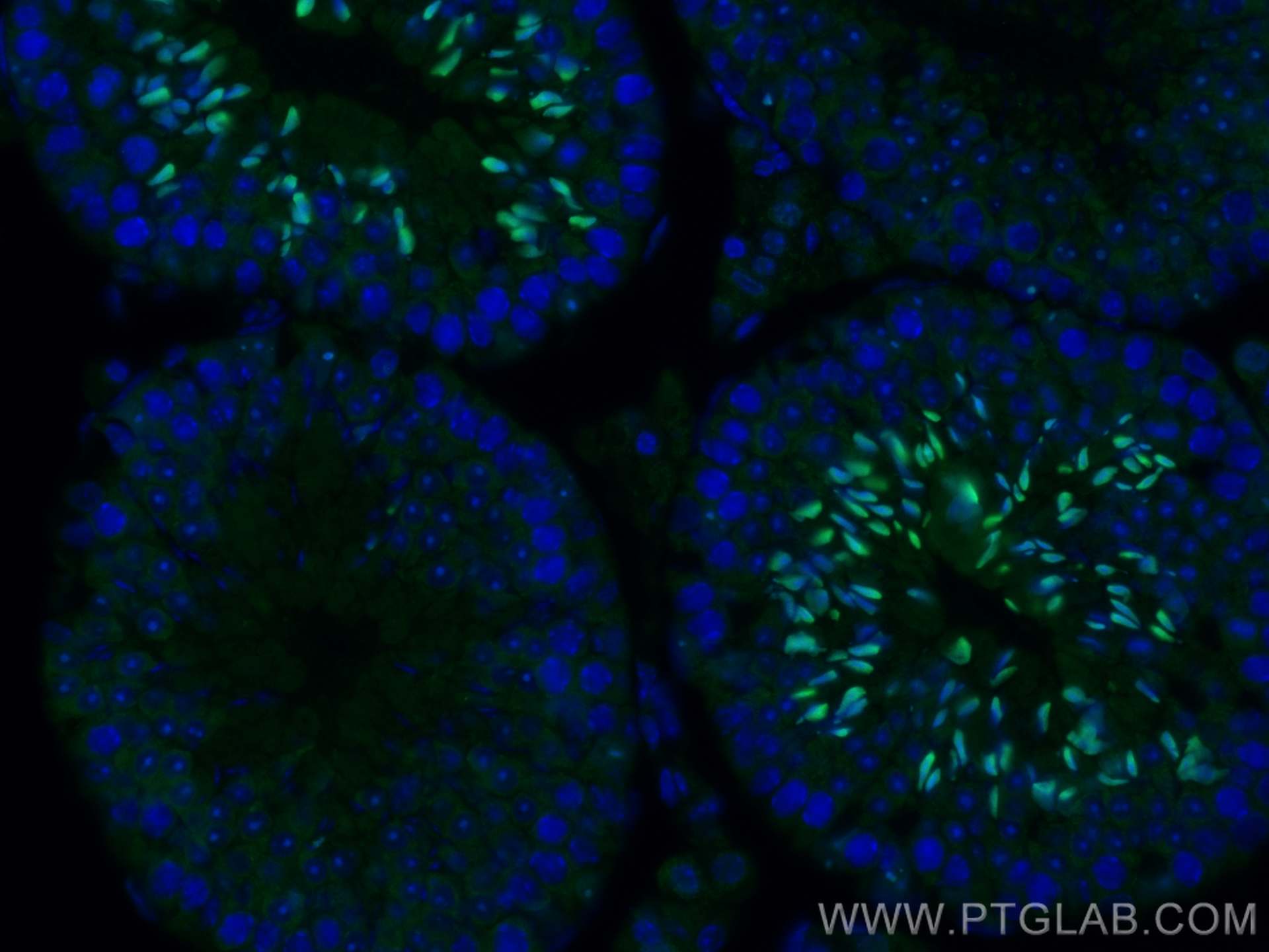 Immunofluorescence (IF) / fluorescent staining of mouse testis tissue using P27; KIP1 Polyclonal antibody (25614-1-AP)