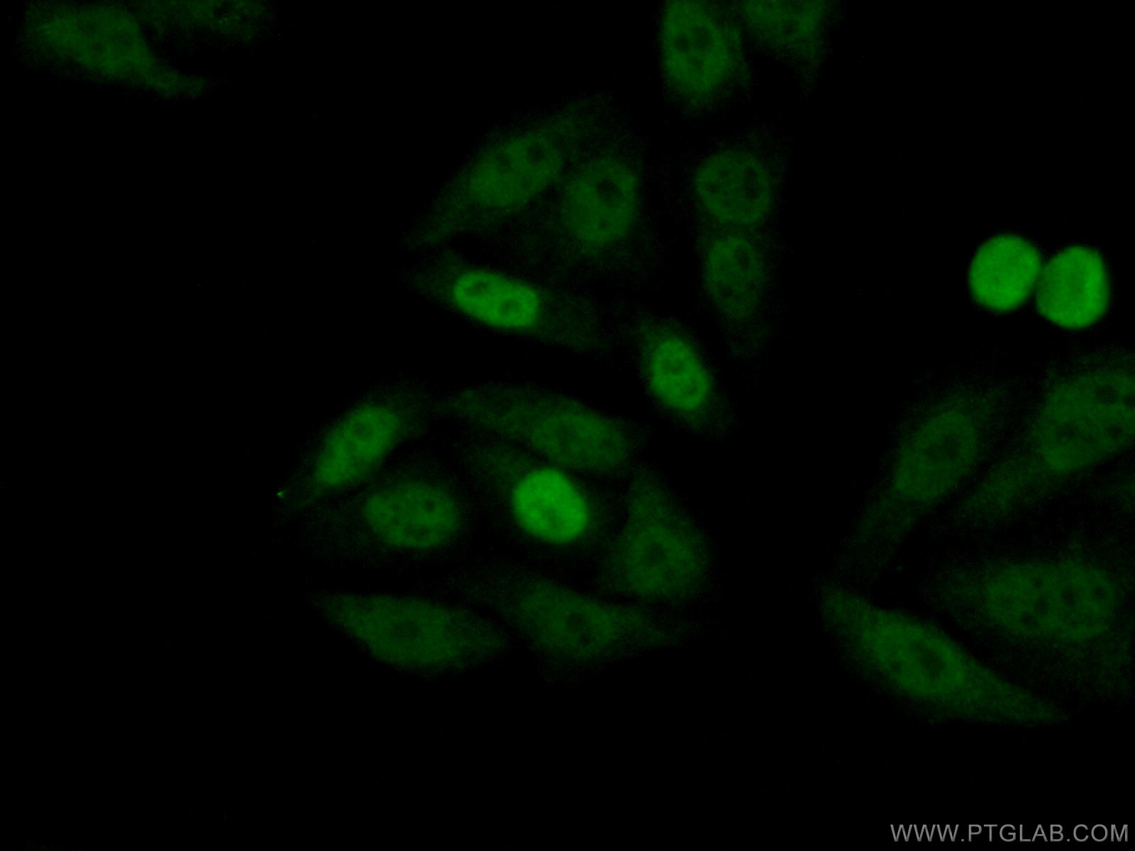 IF Staining of HepG2 using 25614-1-AP