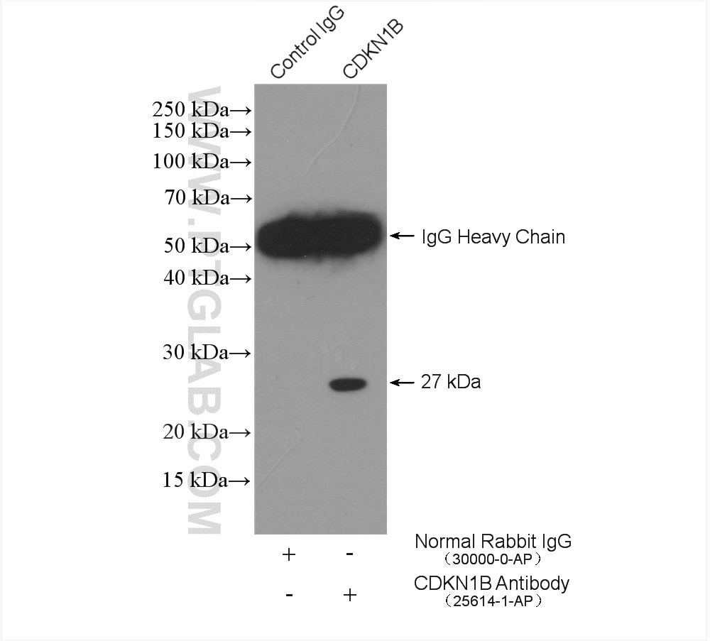 Immunoprecipitation (IP) experiment of NIH/3T3 cells using P27; KIP1 Polyclonal antibody (25614-1-AP)