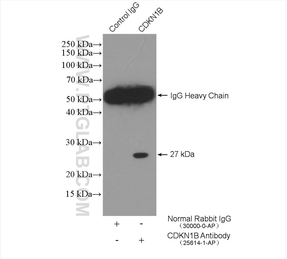 IP experiment of NIH/3T3 using 25614-1-AP