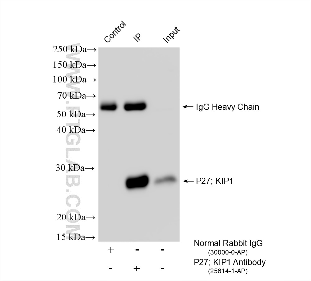 Immunoprecipitation (IP) experiment of NIH/3T3 cells using P27; KIP1 Polyclonal antibody (25614-1-AP)